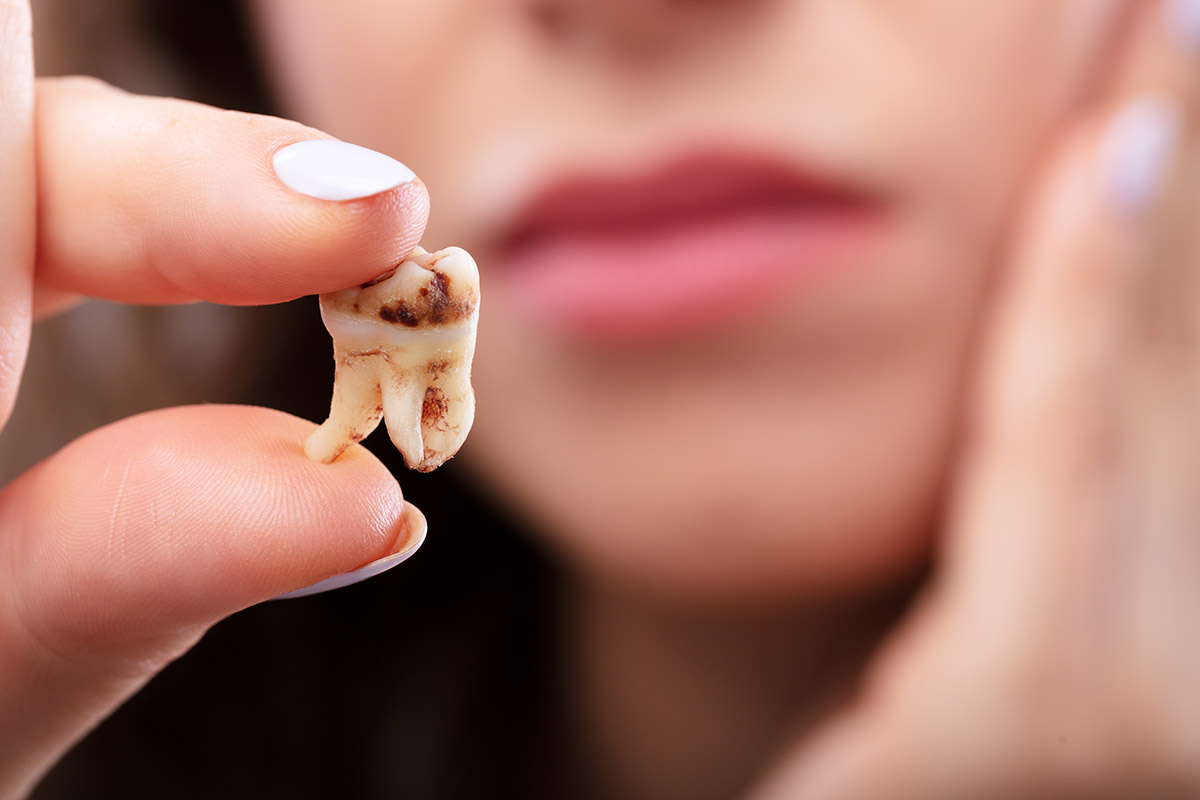 how does tooth decay develop woman looking at tooth wondering how does tooth decay develop