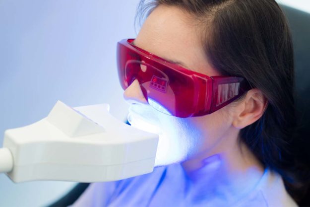 teeth-whitening-options patient experiencing teeth whitening options