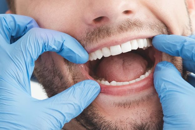 dentist hands in patient mouth checking tongue and oral health