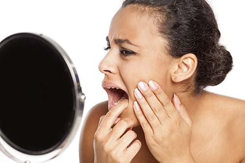 Impacted-Teeth tips for a healthier smile