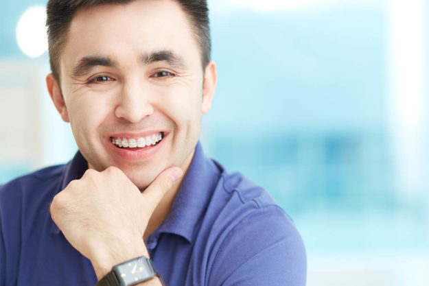5 Signs You Need Dental Braces Again (1) man in need of dental braces